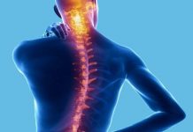 Служба в армии и сколиоз