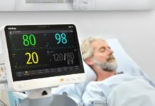 Центральная станция мониторинга в медицине: современные технологии контроля состояния пациентов в реанимации